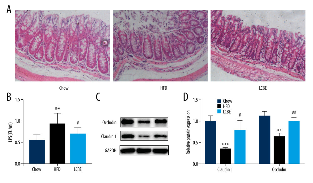 LCBE consolidates the intestinal barrier in mice fed a high-fat diet. (A) Histopathology images of intestine tissues (H&E, 200× magnification). (B) LPS levels in the serum. (C, D) Protein expression levels of occludin and Claudin1 in the intestine. The data are expressed as means±SD. * P<0.05, ** P<0.01, *** P<0.001 vs Chow, # P<0.05, ## P<0.01, ### P<0.001 vs HFD.
