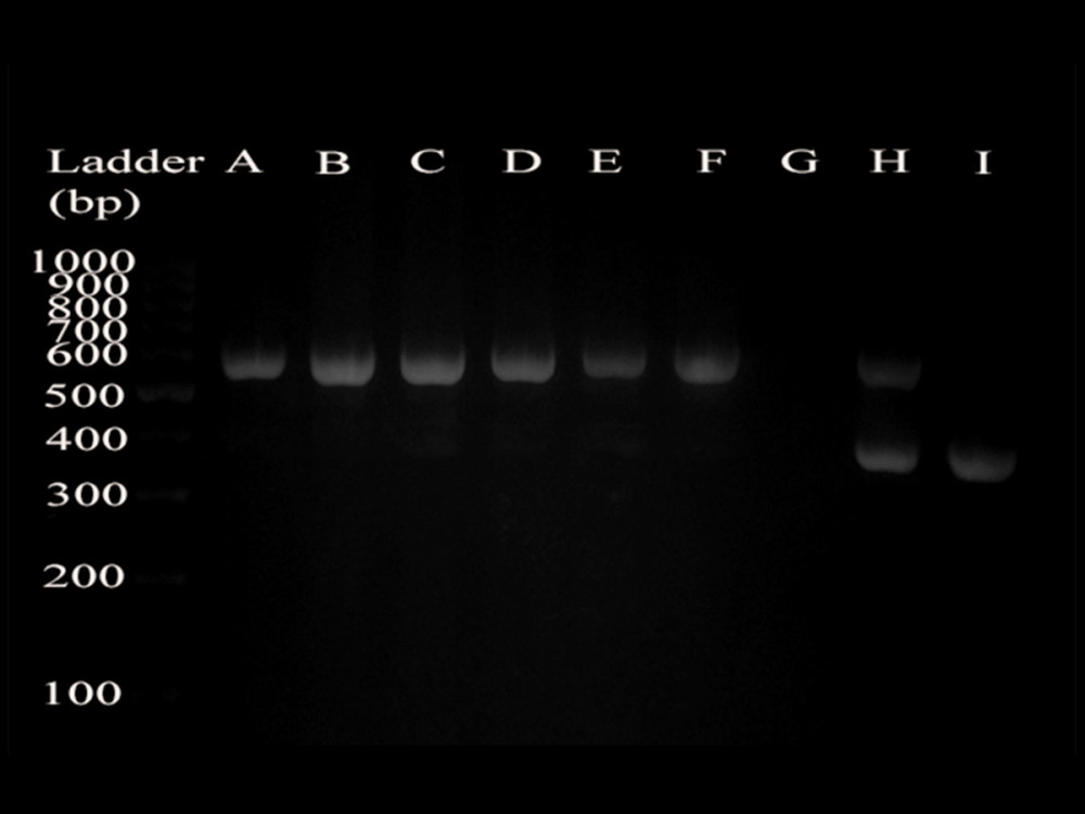 Identification of cannabinoid receptor 2 gene knockout. The extracted DNA from the tails of mice was subjected to PCR reaction and agarose gel electrophoresis, and the following results were obtained: the DNA band of CB2−/− mice (A, B, C, D, E, F) was about 550 bp, and the DNA band of WT mice (I) was about 385 bp. The negative control group (G) did not have any product bands, and the hybrid mice (H) had 2 bands (550 bp and 385 bp).