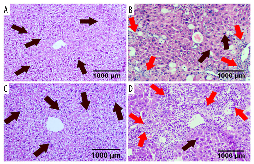 HE staining of liver sections in 4 groups of mice. Deletion of cannabinoid receptor 2 (CB2) aggravated liver damage and inflammatory cell infiltration. (A) WT control group; (B) WT model group; (C) CB2−/− control group; (D) CB2−/− model group. HE, hematoxylin-eosin.