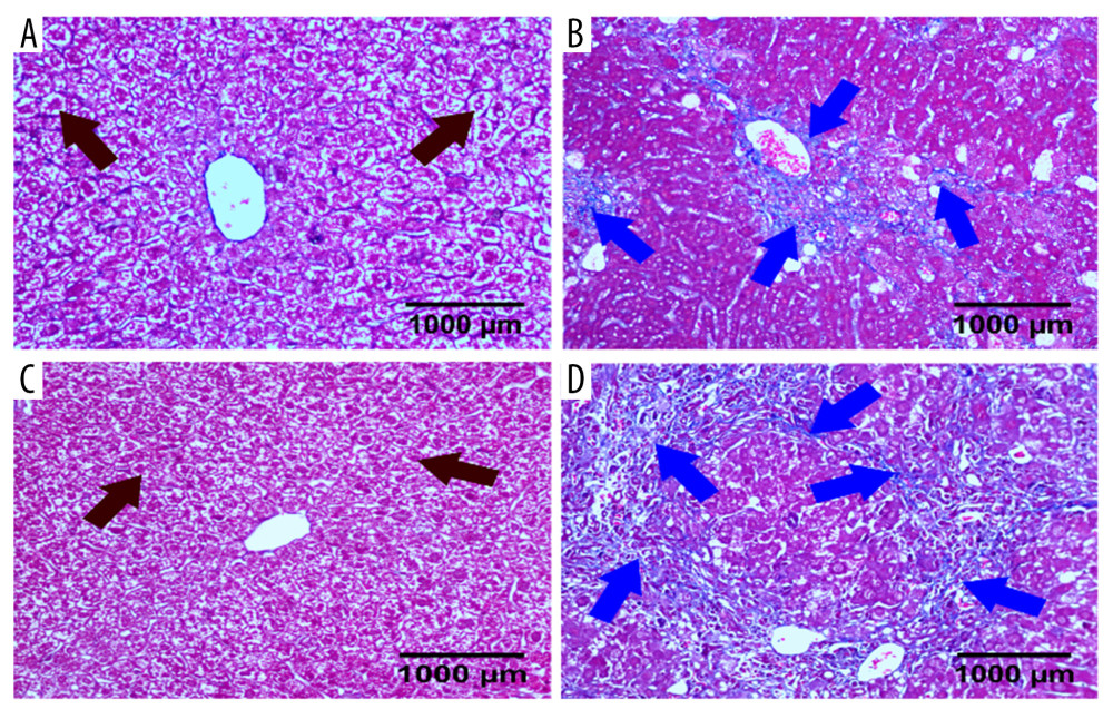 Masson staining of liver sections in 4 groups of mice. Deletion of cannabinoid receptor 2 (CB2) promoted collagen secretion. (A) WT control group; (B) WT model group; (C) CB2−/− control group; (D) CB2−/− model group.