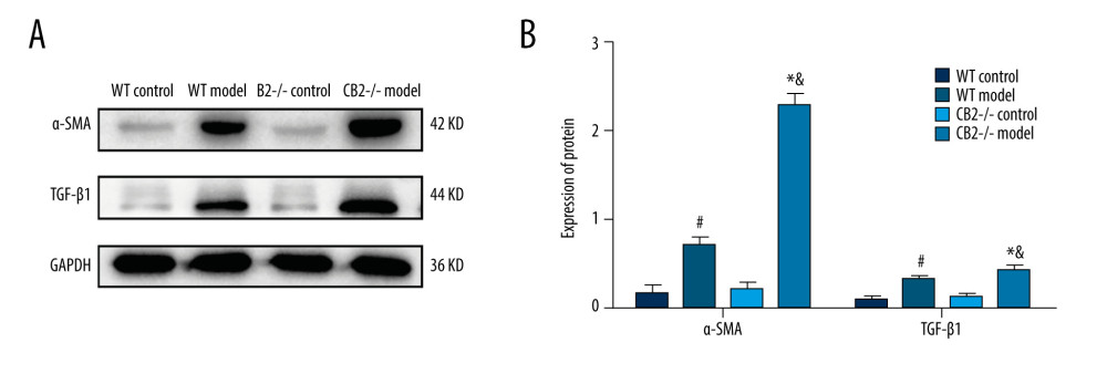 (A, B) Expression of α-SMA and TGF-β1 in liver tissue of 4 groups. Deletion of cannabinoid receptor 2 promoted the activation of HSCs. α-SMA, α-smooth muscle actin; TGF-β1, transforming growth factor-β1. # P<0.05 compared with the WT control group, * P<0.05 compared with the CB2−/− control group, and & P<0.05 compared with the WT model group.