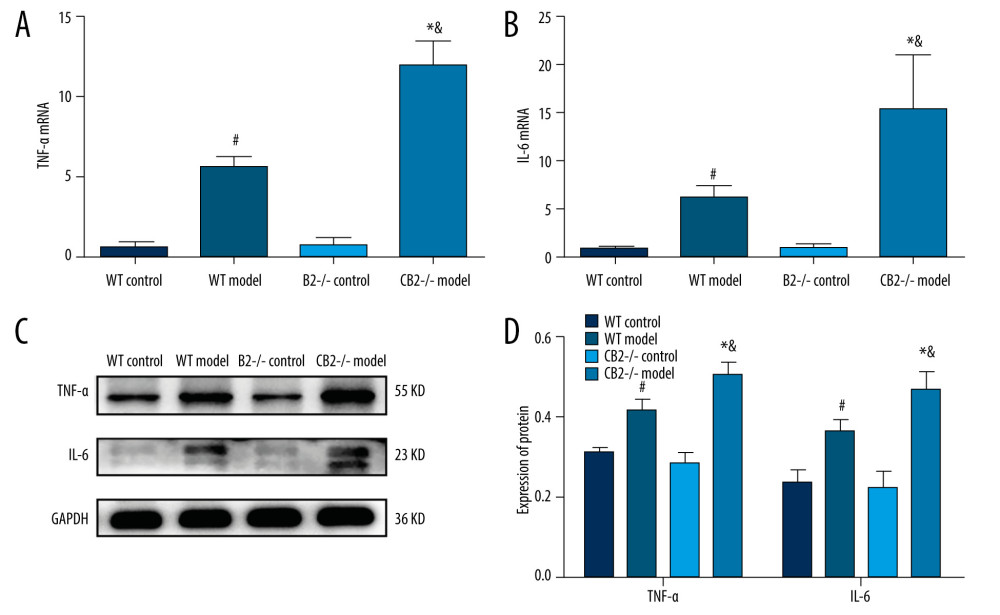 TNF-α and IL-6 mRNA and protein levels of liver tissue in 4 groups. The mRNA expression of TNF-α (A). The mRNA expression of IL-6 (B). The protein expression of TNF-α and IL-6 (C, D). TNF-α, tumor necrosis factor-α; IL-6, interleukin-6. # P<0.05 compared with the WT control group, * P<0.05 compared with the CB2−/− control group, and & P<0.05 compared with the WT model group.