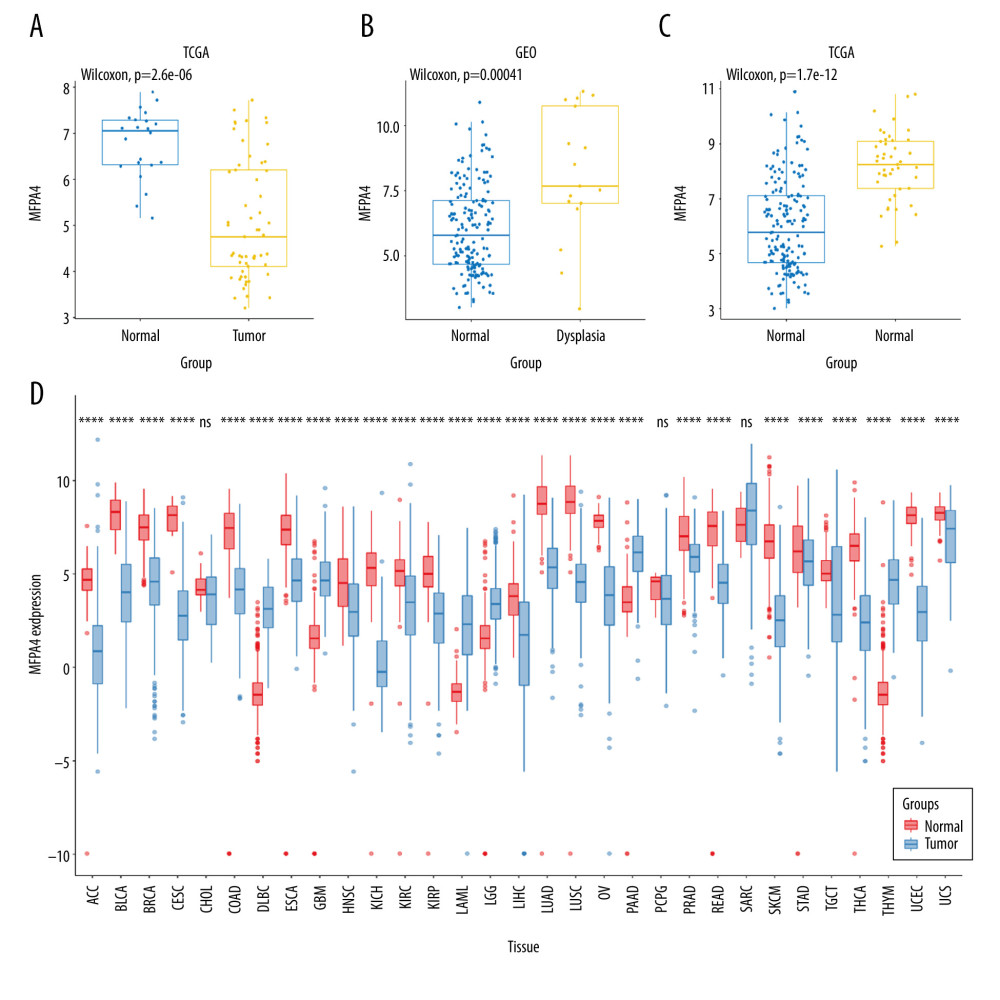 Expression of MFAP4 in tumors. The GEO and TCGA datasets showed that the expression of MFAP4 gene in tumors was lower than that in normal samples (A–C). Pan-cancer analysis showed that MFAP4 gene had significantly lower expression in multiple tumors (D).