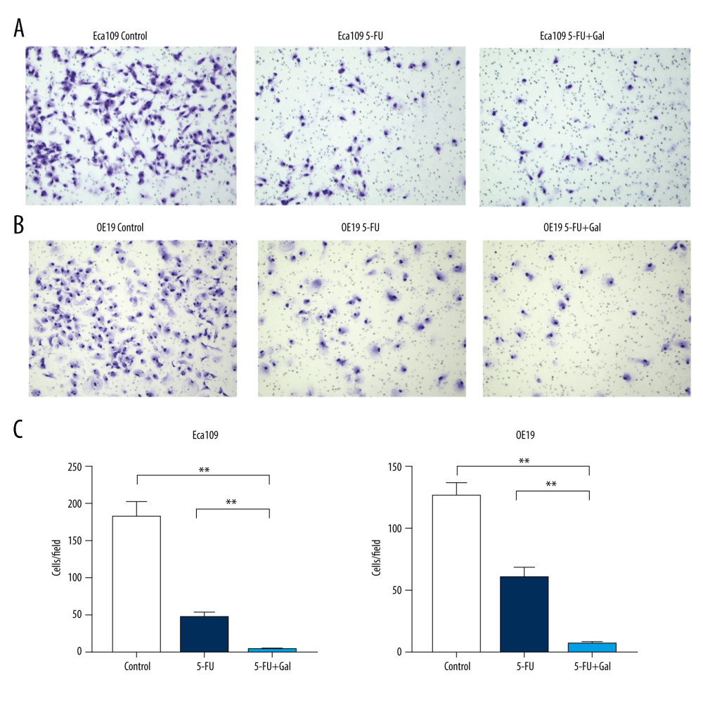 Effects of fluorouracil (5-FU) and galangin on the invasion of human esophageal cancer cells. (A) Eca109 and (B) OE19 cells were treated with 5-FU, galangin, and combined therapy for 24 h and then analyzed with a Transwell invasion assay. (C) Quantitative analyses were conducted, and the data are shown as the mean±SEM of 3 independent experiments. * P<0.05 vs control group; ** P<0.01 vs control group.
