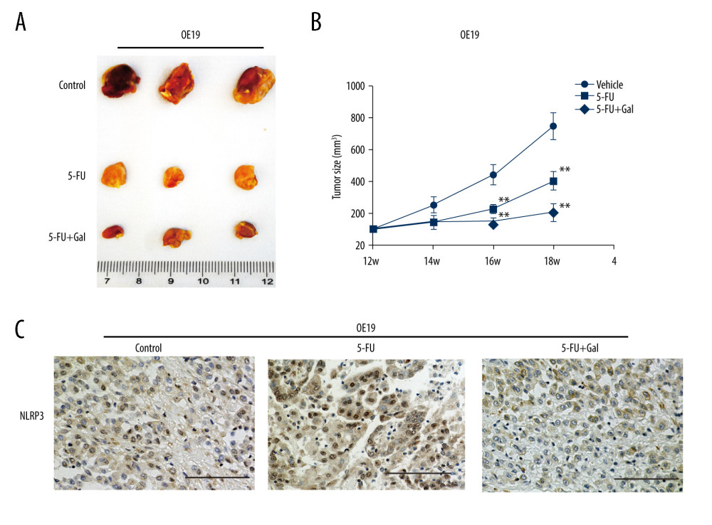 Galangin attenuated the malignant growth of esophageal cancer cells in mice. (A, B) Tumor volumes and representative esophageal tissues after resection in mouse xenograft models. (C) Galangin plus fluorouracil (5-FU) inhibited tumor NLR family pyrin domain containing 3 (NLRP3) expression by immunohistology stain assays. Scale bar, 100 μm.