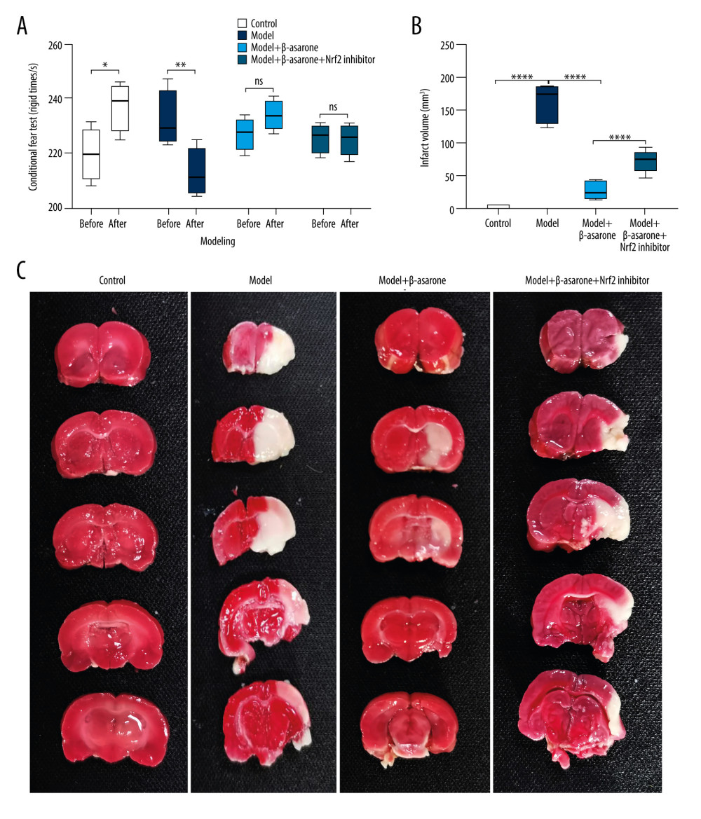 β-asarone ameliorates ischemic brain injury in MCAO rat models. (A) Contextual fear conditioning test for rats 24 h before modeling and 24 h after modeling. (B, C) TTC staining for assessment of the infarct volumes in brain tissues for control, model, and model rats treated with β-asarone and/or Nrf2 inhibitor for consecutive 20 days. Ns – not significant; * p<0.05, ** p<0.01, **** p<0.0001.