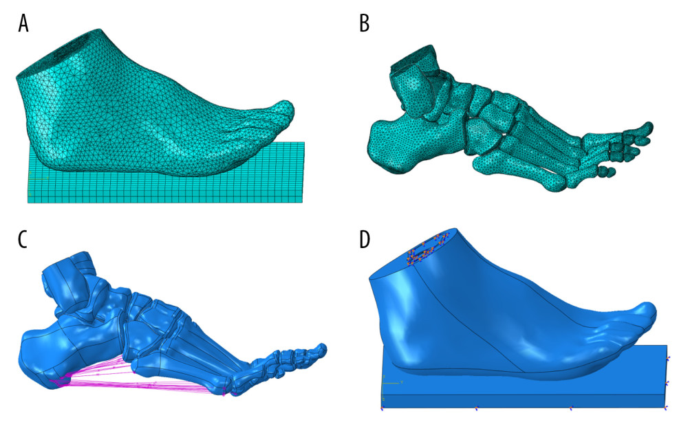Encapsulated soft tissue, bone, and ligament construction and plantar contact area of the finite element foot modelThe models of soft tissue, cartilage, bone, and ligament were imported into ABAQUS software to simulate the foot model. Then, plantar response in the stance phase was simulated by fixing soft tissue of the tibia and fibula. (A) Grid size chart of encapsulated soft tissue; (B) grid size chart of the bone tissue; (C) schematic diagram of foot ligament; and (D) diagram of model contact area in stance phase.