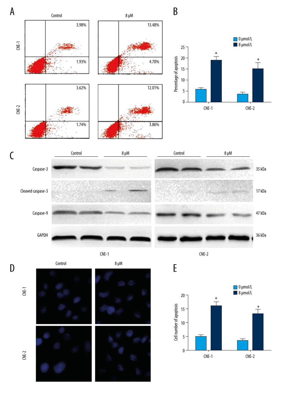 Effect of inhibition of FoxM1 on NPC cell apoptosis and nuclear morphology(A) CNE-1 and CNE-2 cells were exposed to vehicle or 8 μM of thiostrepton for 72 h, and then labeled with annexin-V and propidium iodide (PI) for an apoptosis assay using flow cytometry. (B) Quantification of data in A. (C) The cells were treated as in A for analysis by a western blot assay for protein expression of apoptotic markers caspases-3 and -9 in CNE-1 and CNE-2 cells. GAPDH was used as an internal control. (D) Thiostrepton-treated cells were stained with Hoechst 33258, and their nuclear morphology was observed under an immunofluorescence microscope. (E) Quantification of nuclear morphological impairment shown in D. Quantitative data are expressed as the means±SD for individual groups of cells from 3 separate experiments. * P<0.05 compared to the controls. NPC – nasopharyngeal carcinoma; FoxM1 – forkhead box M1.