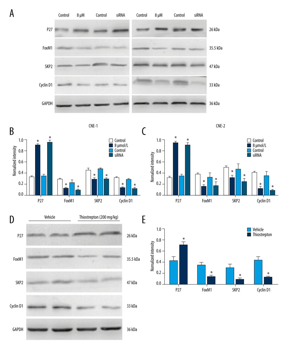 Effect of inhibition of FoxM1 on Wnt/β-catenin signaling activity in NPC cells and NPC xenograft tissues(A) CNE-1 and CNE-2 cells were exposed to vehicle or 8 μM thiostrepton for 72 h, and then the protein expression of Wnt/β-catenin signaling-related proteins was evaluated by western blotting, as indicated. (B) Quantitative data for relative protein expression in CNE-1 cells. (C) Quantitative data for relative protein expression in CNE-2 cells. (D) At 42 days after intraperitoneal injection of vehicle or thiostrepton at a dose of 200 mg/kg body weight, the NPC xenografts were harvested. Tissue lysates were collected, and the protein expression of Wnt/β-catenin signaling-related proteins was evaluated by western blotting, as indicated. Protein expression levels were normalized to the expression level of GAPDH, and the results were then further quantified. (E) Quantitative data for relative protein expression in D. * P<0.05 compared to the control.