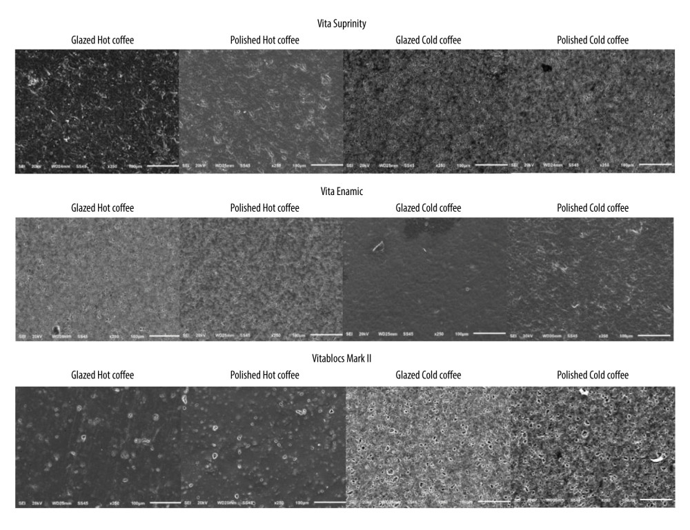 Representative SEM image of tested CAD/CAM materials “Vita Suprinity, Vita Enamic, and Vitablocs Mark II” at ×250 magnification after staining and aging.