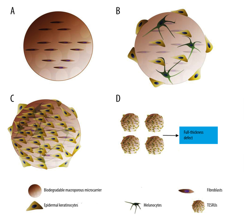 Schematic diagram of construction the TESRUs: (A) First, autologous fibroblasts are loaded on a biodegradable macroporous microcarrier. (B) Second, autologous epidermal keratinocytes and melanocytes are incubated with the fibroblast-loaded microcarriers. (C) Autologous epidermal keratinocytes and autologous melanocytes are expanded in the fibroblast-loaded microcarriers, which are regarded as the smallest unit with complete full-thickness skin regeneration ability. (D) Multiple TESRUs are delivered to the wound surface to regenerate the full-thickness skin.