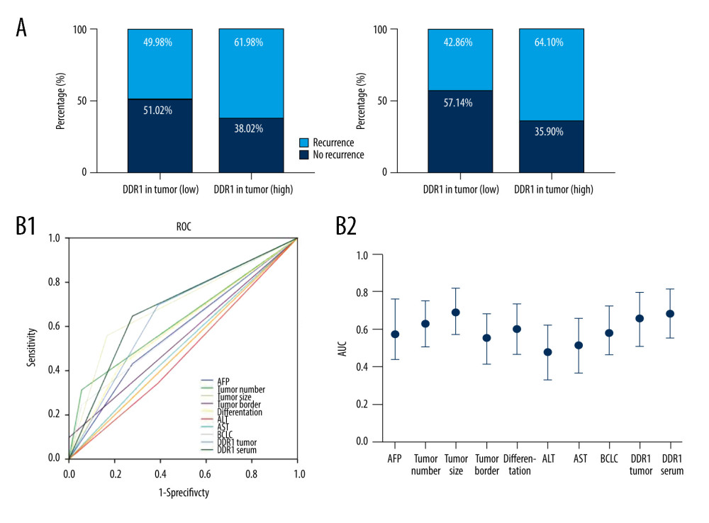 Increased DDR1 in serum and in tumors was associated with poor outcome of HCC patients. (A) HCC patients with high expression of DDR1 trended to have high possibility of recurrence and metastasis. (B) ROC analysis of different variables for predicting recurrence (B1) and AUC (B2).