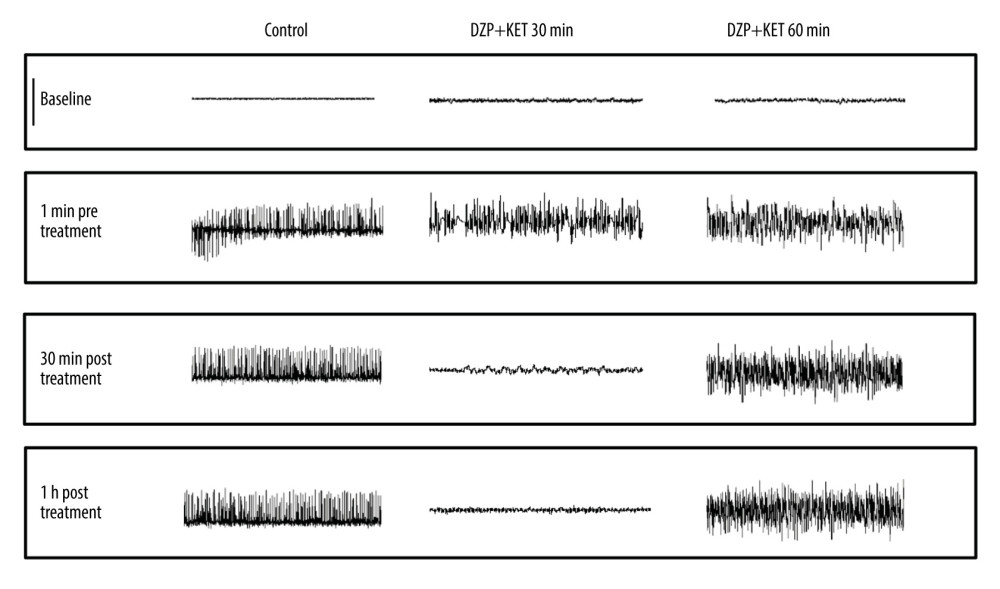 Representative EEG recordings from hippocampal electrodes (Omniplex Neural Data Acquisition System, Plexon, Inc.) in control, 30 min, and 60 min SE with diazepam-ketamine dual therapy. SE was induced via injection of lithium chloride (5 mEq/kg, i.p.) and pilocarpine hydrochloride (40 mg/kg, i.p.) 16 h later. The rats in each time point group were treated with the same volume of placebo (control, n=5) or 10 mg/kg diazepam combined with 45 mg/kg ketamine (n=8) at 10, 20, 30, 40, 50, or 60 min SE. As illustrated in the post-treatment traces, dual therapy at 10 min to 30 min SE initially eliminated the epileptiform discharges. Behavioral seizure activity was also terminated. The SE EEG pattern exhibited no changes when dual therapy was administered after 50 min or 60 min SE. Five animals in the 40-min group were controlled well with dual therapy. but the other 3 animals exhibited apparent seizure discharges in EEG despite the disappearance of faint myoclonia during narcosis. Each trace represents a 20-s period: scale bar (upper left), 800 μV.