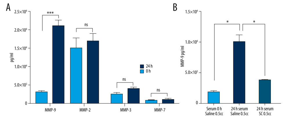 Optimal blood incubation conditions for interleukin (IL)1-ra production facilitate the synthesis of matrix metalloproteinase (MMP)-9, which is reversed by sodium citrate (SC) addition. (A) Comparison of the MMP-9, MMP-2, MMP-3, and MMP-7 protein concentrations in human blood samples before (baseline level) and after incubation at 37°C for 24 h. Two-way analysis of variance (ANOVA) revealed a statistically significant increase in the levels of MMP-9 at 24 h after incubation (*** P<0.001; nonsignificant [ns], P>0.01). (B) Two-way ANOVA revealed that the presence of SC has a negative impact on MMP-9 secretion by blood cells compared with saline controls (* P<0.01). The figure was created using ImageJ software version 1.53e; Java 1.8.0_172.