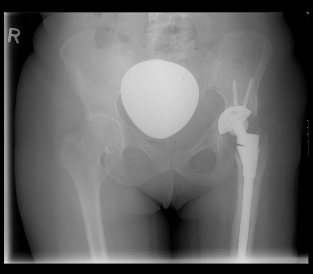 Postoperative X-ray.
