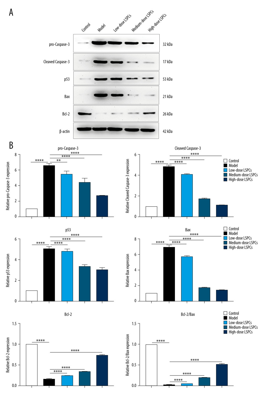 Treatment of LSPCs alleviated light exposure-induced cell apoptosis in retina. (A) Representative photos of western blotting for pro-Caspase-3, cleaved Caspase-3, p53, Bax as well as Bcl-2 proteins. (B) Quantification of the expressions of pro-Caspase-3, cleaved Caspase-3, p53, Bax, and Bcl-2 as well as Bcl-2/Bax ratio in retina from control, light-induced retinal damage model, low-, medium-, and high-dose LSPCs groups. ** P<0.01; **** P<0.0001. GraphPad Prism software (version 8.0.1; Graph Pad; San Diego, CA, USA) was used to create the pictures.