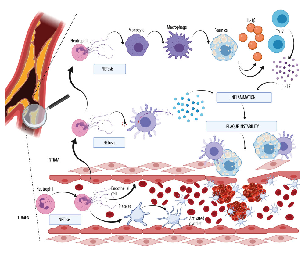The role of neutrophil extracellular trap formation (NETosis) in the development of atherosclerotic plaque. The scheme was depicted with BioRender (biorender.com).