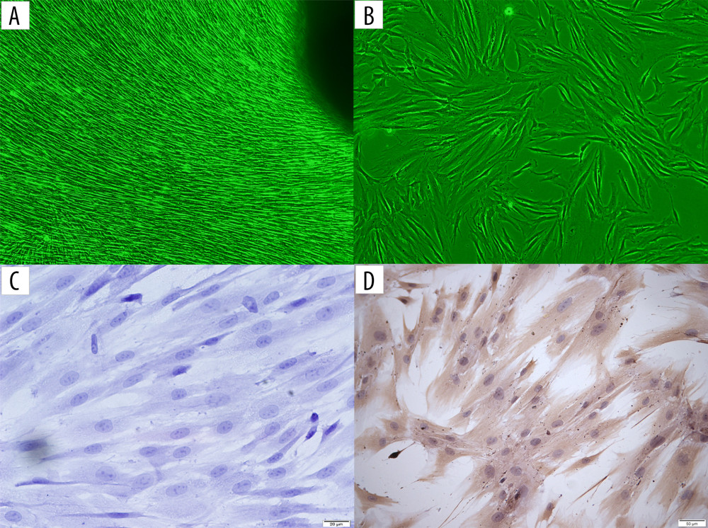 (A) The primary culture cells of human gingival fibroblasts (HGFs) (inverted microscope, 100×). (B) The fourth generation of culture cells of HGFs (inverted microscope, 100×). (C) Immunocytochemical staining showing cytoplasm of cultured HGFs was negative for cytokeratin (inverted microscope, 400×). (D) Immunocytochemical staining showing cytoplasm of cultured HGFs was positive for vimentin (inverted microscope, 200×).