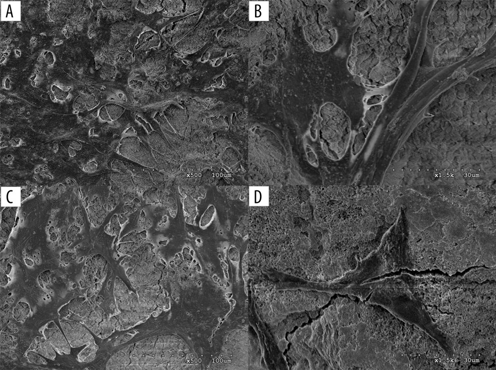 In group B (Er: YAG laser), the cells adhered well and grew densely. (A–D) Scanning electron microscope (SEM) at 24 h, 500×; 24 h, 1500×; 48 h, 500×; and 48 h, 1500×.