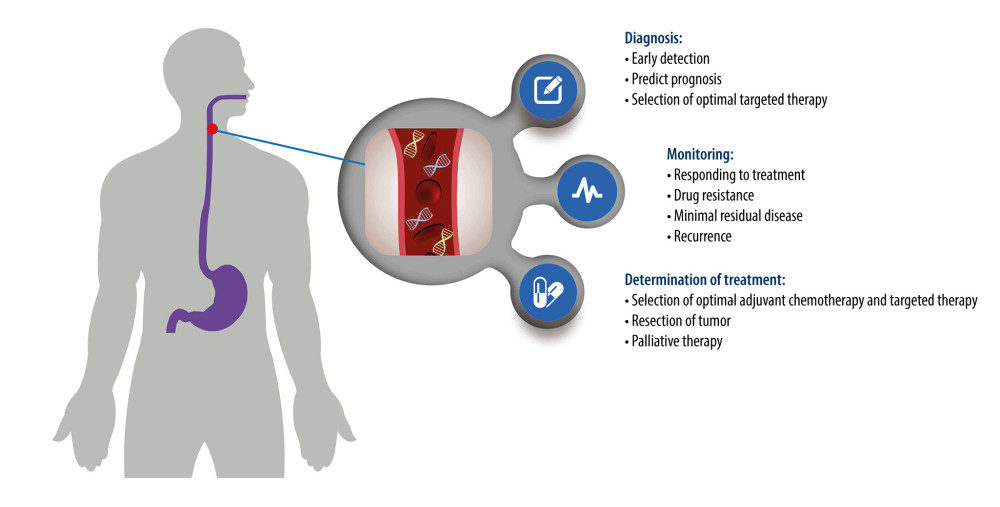 Clinical utility of circulating tumor DNA (ctDNA) for esophageal cancer.