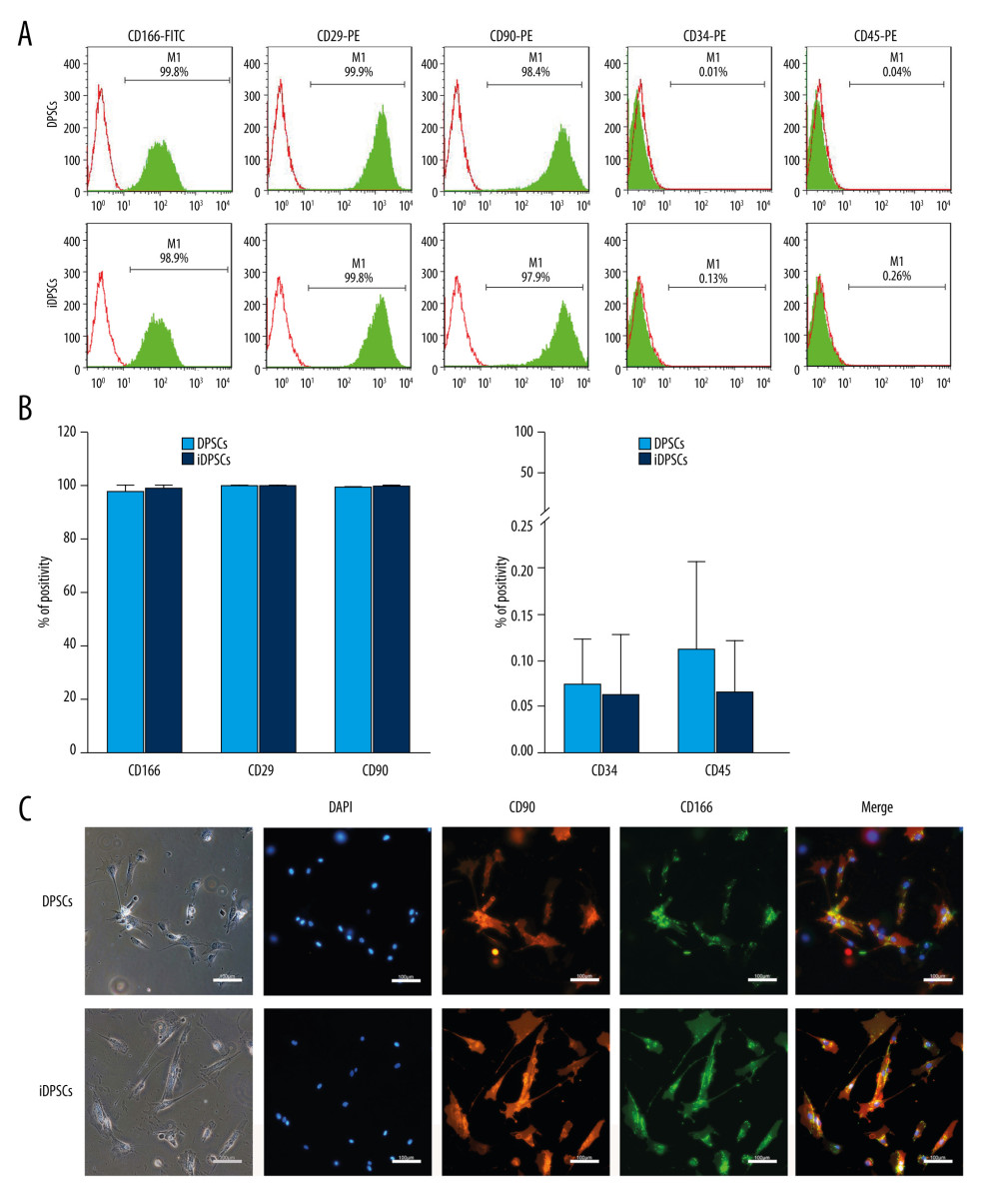 The immunophenotype characteristics of the DPSCs and iDPSCs. (A) Immunophenotype analysis by flow cytometry. The third-passage cells were incubated with monoclonal antibodies against the cell-surface marker antigens CD29, CD90, CD166, CD34, and CD45, followed by fluorescein-conjugated secondary antibodies. Both DPSCs and iDPSCs showed similar cell-surface marker expressions. (B) The percentage of positivity of the markers were calculated from 5 samples. (C) Immunofluorescence staining. The nuclei were stained with DAPI (blue). Both DPSCs and iDPSCs co-expressed CD166 and CD90 (magnification, ×20; Scale bar, 100 μm). DPSCs – dental pulp stem cells; iDPSCs – inflammatory dental pulp stem cells; MSCs – mesenchymal stem cells; DAPI – 4′,6-diamidino-2-phenylindole. (Figure were created using Adobe Photoshop CS3, Adobe Systems Software Ireland, Ltd.).