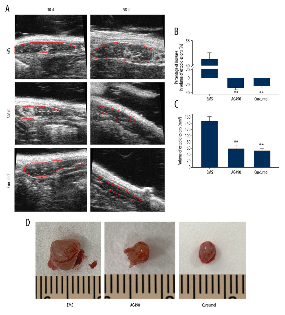 Effect of curcumol on growth of ectopic lesions in EMS model rats. (A) The volume of ectopic lesions was detected by B-ultrasound (the lesions are marked by red line). (B) Percentage of volume proliferation of ectopic lesions calculated from B-mode ultrasound results. (C) The ectopic lesion volume calculated according to caliper measurement. (D) The appearance of ectopic lesions. The experiments were performed in duplicate, and the results were expressed as mean±SD. Compared with control group, ** P<0.01.