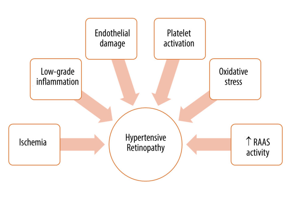 Factors involved in the pathogenesis of hypertensive retinopathy. RAAS – renin-angiotensin-aldosterone system. Figure was prepared in Microsoft PowerPoint 2019 (Microsoft Corporation).