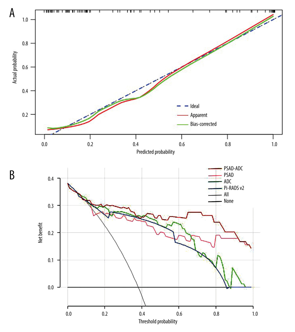 (A)The calibration curve based on internal validation. The blue dotted line represents the performance of the ideal model. The red and green solid lines represent the performance of the combined model without and with bias correction. (B) Decision curves show that the combined model (prostate-specific antigen density [PSAD]+apparent diffusion coefficient [ADC]) added more benefit over ADC, PSAD, and PI-RADS v2 in a wide range threshold of probability. (R 4.0.3, The R Foundation for Statistical Computing).