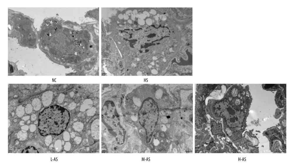 Changes in lung ultrastructure in a heatstroke rat model pretreated with isorhamnetin. NC – normal control; HS – heatstroke; L-AS – low-dose isorhamnetin; M-AS – medium-dose isorhamnetin; H-AS – high-dose isorhamnetin.