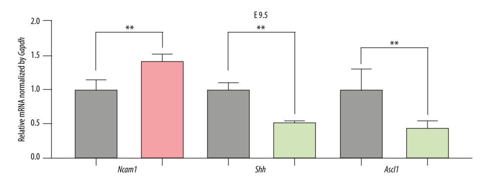 The expression of candidate genes in E9.5. Gray: Control; Red: Upregulated in NTDs; Green: Downregulated in NTDs. n=3,* P<0.05, ** P<0.01, *** P<0.001. Data were analyzed and visualized using the software GraphPad Prism, version 8.0, supported by GraphPad Software.