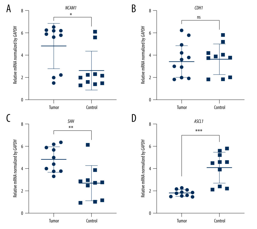 The expression of candidate genes in GBM samples. (A) NCAM1. (B) CDH1. (C) SHH. (D) ASCL1. n=10,* P<0.05, ** P<0.01, *** P<0.001, ns – not significant. Data were analyzed and visualized using GraphPad Prism, version 8.0, supported by GraphPad Software.
