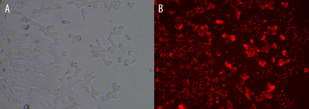 Cell transfection efficiency. (A) Before transfection; (B) After transfection. The figure was created using Olympus CKX53-FL manufactured by Olympus Corporation.