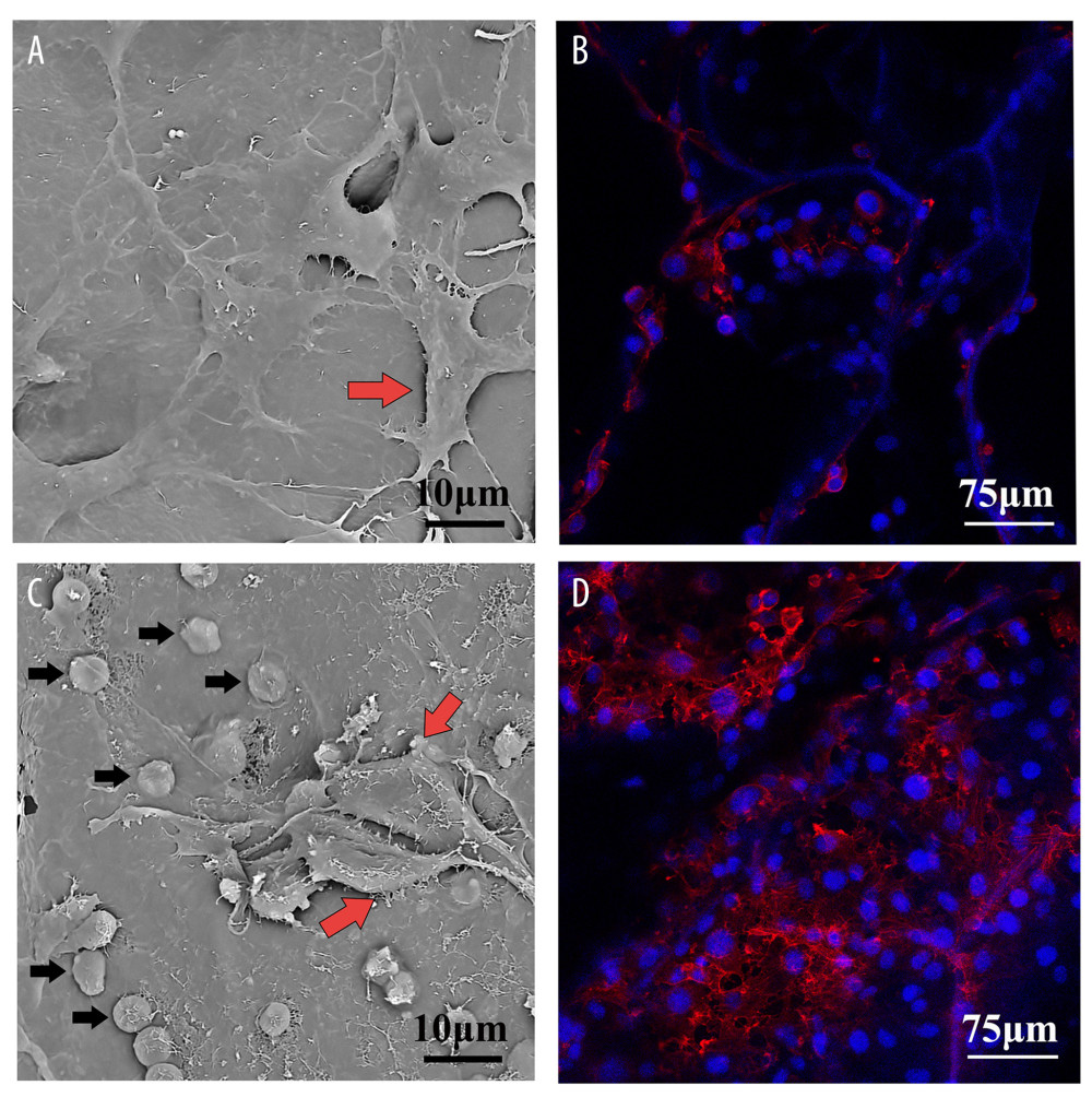 Cell adhesion and proliferation on the surface of the AD scaffold and AD/PRP composite scaffold. (A) The SEM result of HUVECs on AD scaffolds, red arrows point to cells. (B) The fluorescence staining result of HUVECs on AD scaffolds. (C) The SEM result of HUVECs on AD/PRP scaffolds, red arrows point to cells and black arrows point to platelet granules. (D) The fluorescence staining result of HUVECs on AD/PRP scaffolds. Images were processed using Photoshop software (Adobe Photoshop CS6 USA).