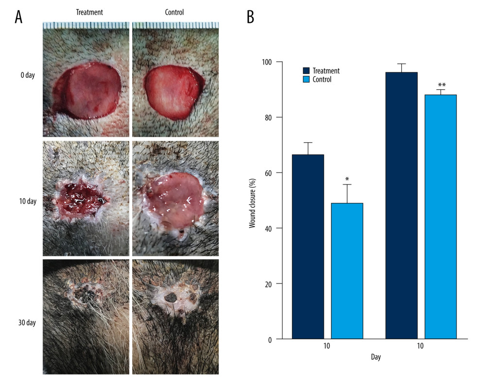General view of the repair effects in AD scaffolds and AD/PRP composite scaffolds: the treatment group on the left and the control group on the right. (A) Fabrication of skin defect model in pig heads on day 0 and after treatment on day 10 and day 30. (B) Statistical plot of wound healing rate. * P<0.05 and ** P<0.01 relative to the control group. Images were processed using Photoshop software (Adobe Photoshop CS6 USA).
