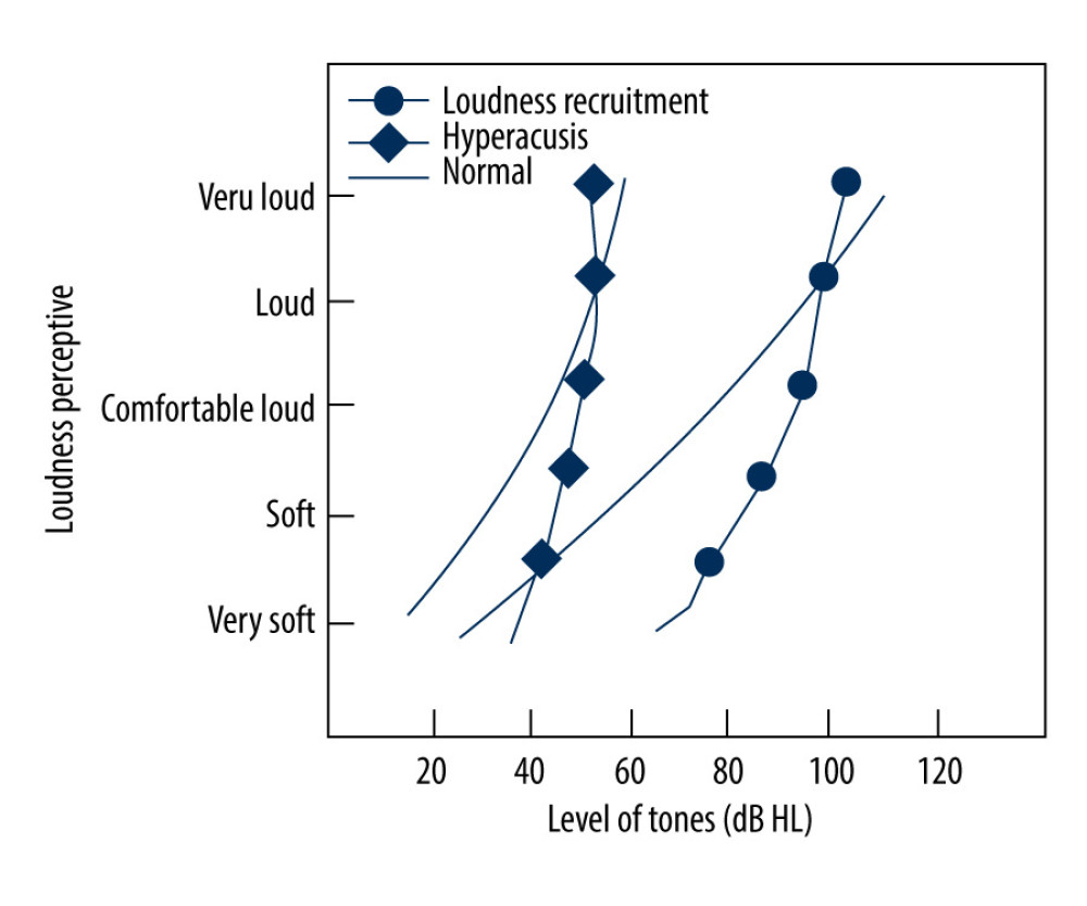 Loudness models for normal subjects, patients with loudness recruitment, and patients with hyperacusis (Cox, 1997). The maximum discomfort threshold for a normal person is 100 dB HL. Patients with loudness recruitment have a largely unchanged maximum discomfort threshold, although they often have sensorineural deafness, while some patients with hyperacusis have an increased hearing threshold, the maximum discomfort threshold falls to 70–80 dB instead, thus the range of hearing tolerance is significantly reduced.