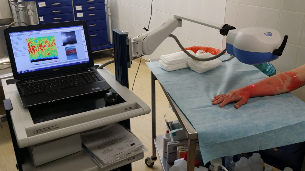 Medical Science Monitor Evaluation of BromelainBased Enzymatic