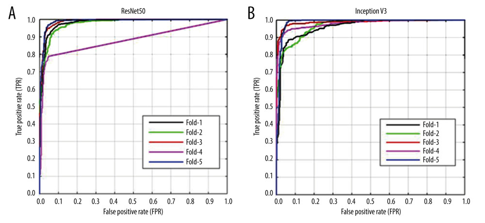 (A, B) Receiver operating characteristic (ROC) curves for methods to predict pulmonary nodules of the 2 transfer learning models (ResNet50 and Inception V3) (image-level). The x-axis represents the false-positive rate (FPR) and the y-axis represents the true-positive rate (TPR). Created using matplotlib version 2.2.2 (Python 3.6).