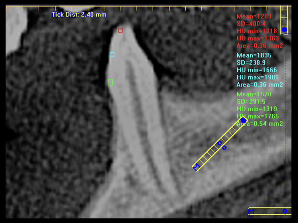 The measurement of the HU values on the CBCT image.