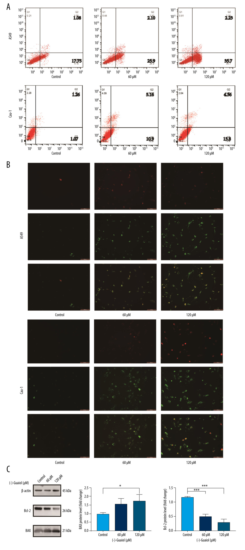 (A) Flow cytometry to detect the apoptosis rate in A549 and Calu-1 treated with different concentrations of (−)-Guaiol. (B) Fluorescence microscope was used to observe apoptosis in A549 and Calu-1 treated with different concentrations of (−)-Guaiol. (C) Western blot analysis was used to detect the protein expression of BAX and Bcl-2 in A549 treated with (−)-Guaiol (60 μM or 120 μM). The relative BAX and Bcl-2 levels from 3 independent experiments were statistically analyzed using ANOV A test in the quantitative analysis. * P<0.05, *** P<0.001 vs control.