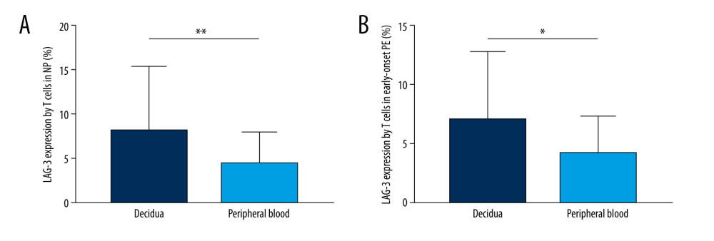 (A, B) The comparison of LAG-3 expression between peripheral and decidual T cells in NP and early-onset PE. Statistical comparisons were made by paired t test. Data are presented as the mean±SEM. P value <0.05 was considered to be statistically significant. * P<0.05, ** P<0.01. NP – normal pregnancy; Early-onset PE – early-onset preeclampsia. GraphPad Prism software, version 7 (GraphPad) was used to create the figures.