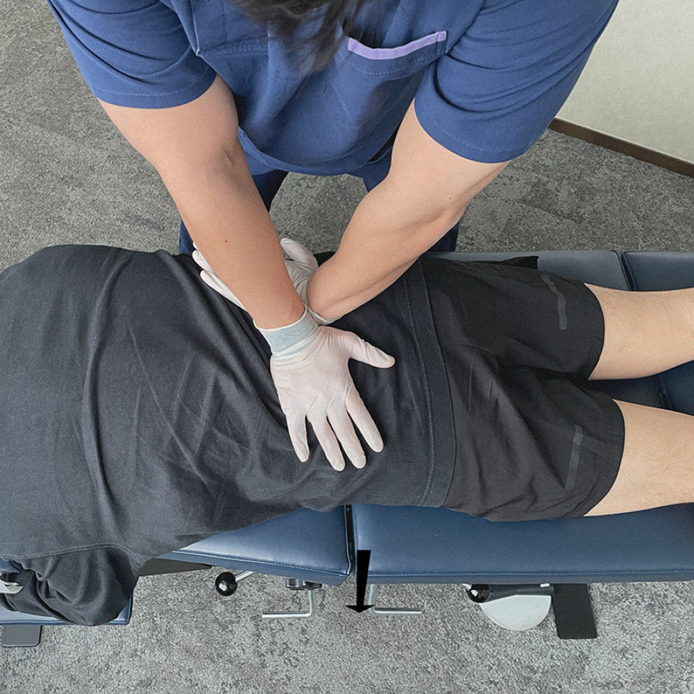 Drop table technique. The patient is positioned prone on the table with the segments to be manipulated overlying the cushioned drop section of the table. The tension is set so that the patient’s body weight by itself will not cause the section to drop. Additional force is applied (in this case, using contacts from both hands at L5 and the ilium), which exceeds the resistance of the drop mechanism, causing the table section to drop a short distance vertically beneath the patient (arrow). Image from EC.