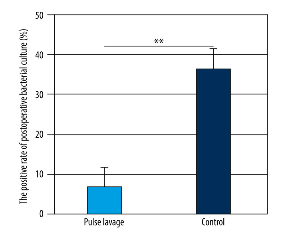 The positive rate of postoperative bacterial cultures of the 2 groups. The positive rate of postoperative bacterial cultures of the pulsed lavage group was significantly lower than that in the control group, with ** P<0.01. Microsoft Excel (version 2209) was used for figure creation.
