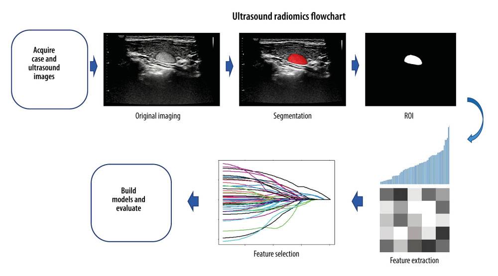 The picture uses an ultrasound image case of a thyroid nodule, showing the workflow of the ultrasound radiomics. Region of interest (ROI) segmentation was conducted on the largest diameter of the thyroid nodule. Radiomics features were extracted from ROI, including features such as shape, grayscale, texture, and wavelets. The feature selection process is shown with LASSO as an example.
