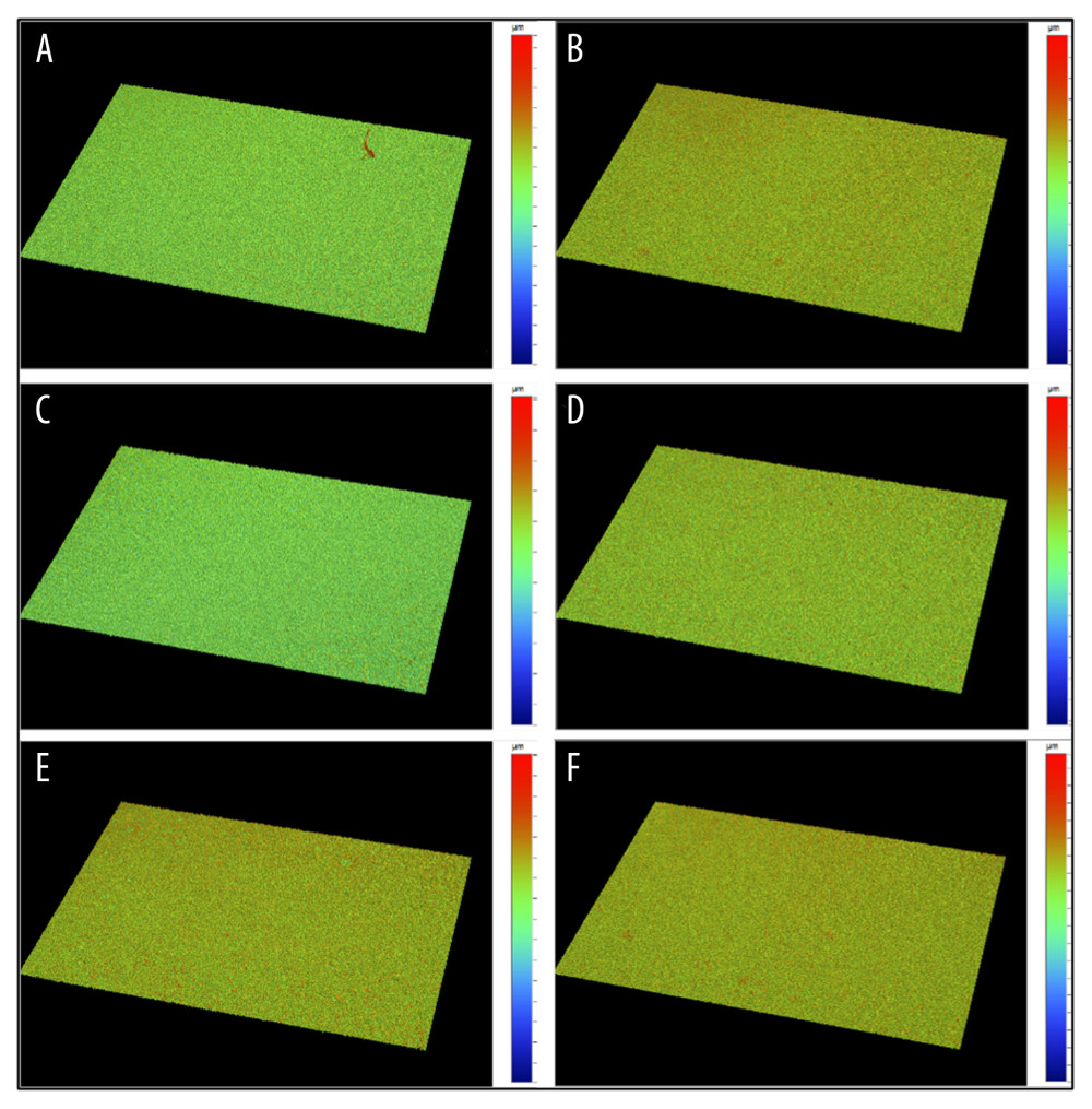 Representative white light interferometer microscope images of Vita Suprinity (A, B), Vita Enamic (C, D), and Vitablocs® Mark II (E, F) CAD/CAM materials with glazed and polished surfaces under ×50 magnification.
