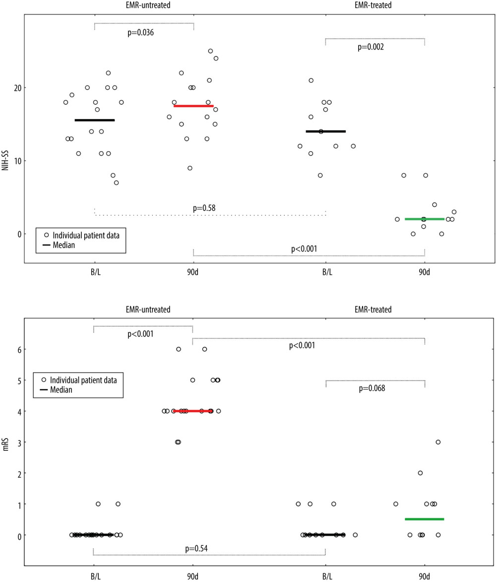 Evolution of National Institutes of Health Stroke Scale (NIHSS), (A) and functional status (modified Rankin Score – mRS), (B) in patients not treated and treated with EMR (Emergency Mechanical Reperfusion). Individual patient and group data on acute ischemic stroke of carotid artery origin (AIS-CA) clinical severity (NIHSS, A) and patient functional status (mRS, B) are provided at baseline at 90 days. Emergency mechanical reperfusion (EMR) treatment effect is demonstrated by comparison of EMR-untreated (natural history, left) and EMR-treated patients (right). With the particularly large volume of cerebral tissue-at-risk in AIS-CA, EMR profoundly impacts clinical outcomes. Note the striking difference in NIHSS and mRS at 90 days in EMR-treated patients versus those who did not receive mechanical reperfusion. The EMR-untreated patients would have been accepted for treatment in the cardioangiology cathlab-based Thrombectomy-Capable Stroke Center (operator team with experience in proximal-protected carotid artery stenting). The figure was created with the use of Statistica 10 (StatSoft GmBH, Hamburg, Germany).