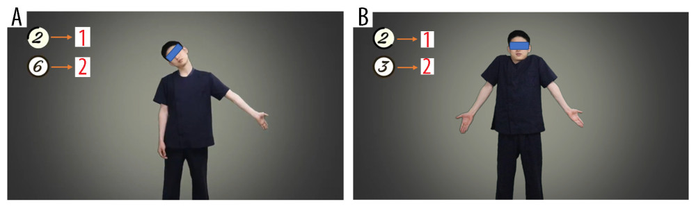 (A) Screenshot of training video for self-upper-extremity neural mobilization. 1. The number in the circle shows exercise time; 2. The number in the circle shows number of exercise repetitions. (B) Screenshot of educational video for shrug exercise. 1. The number in the circle shows exercise time; 2. The number in the circle shows number of exercise repetitions.