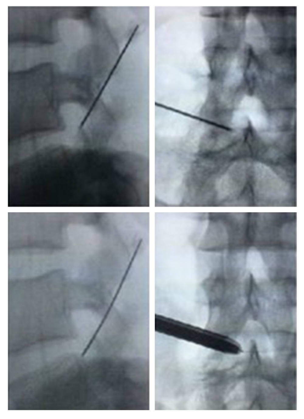 Medical Science Monitor Application of Musculoskeletal Ultrasound