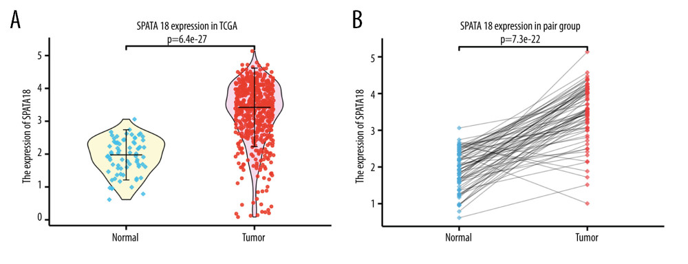 SPATA18 mRNA expression in ccRCC patients. (A) Normal tissues and tumor tissues(P=3.7e-27). (B) Expression in ccRCC tissues and adjacent tissues (P=7.3e-22) (R studio, version 3.6.3).