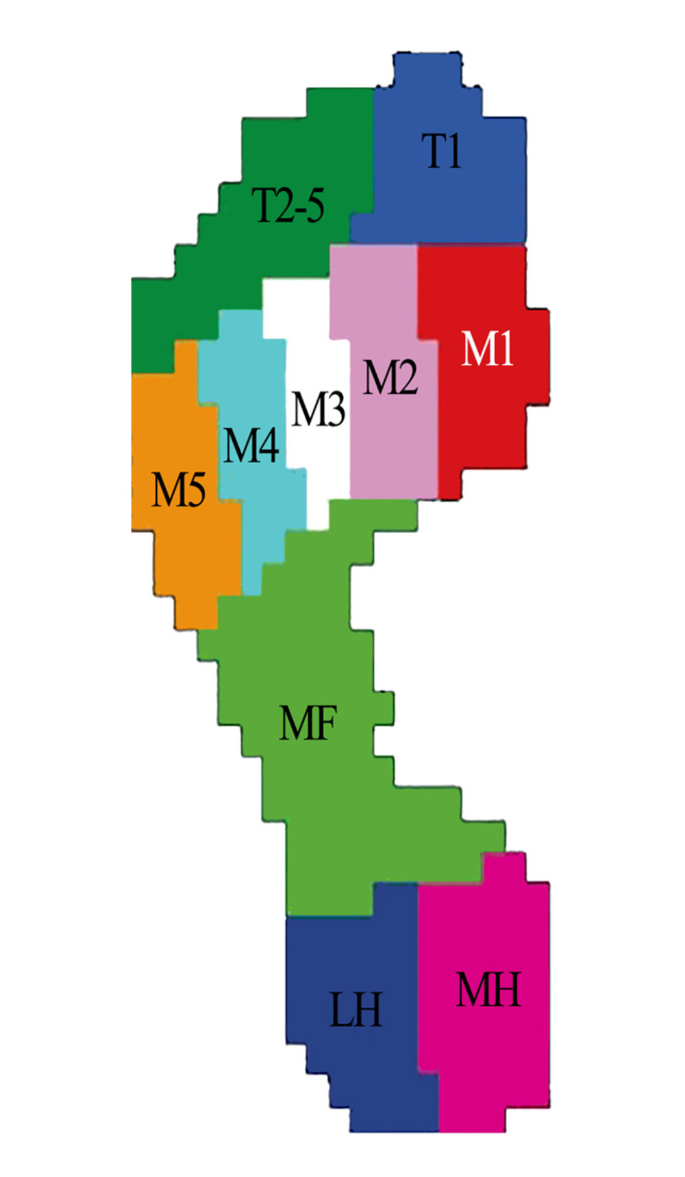 Schematic diagram of dynamic plantar pressure masked zones.The 10 masked zones include: hallux (T1), toes 2–5 (T2–5), first to fifth metatarsals (M1, M2, M3, M4, and M5), midfoot (MF), medial heel (MH), and lateral heel (LH).