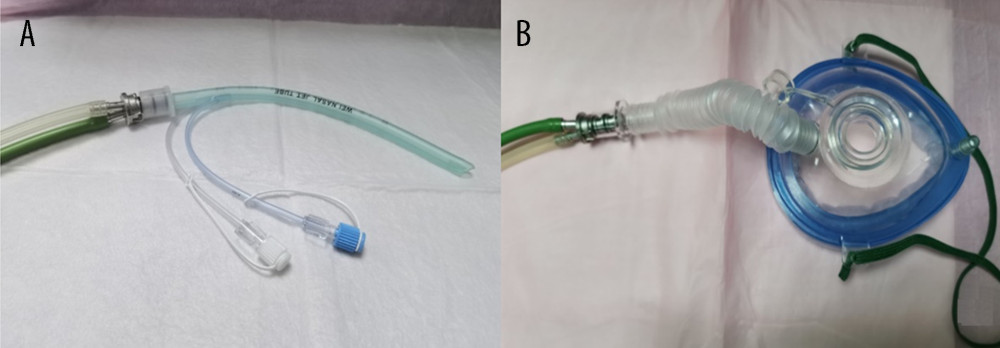Connection of Wei Nasal Jet® tube (A) and endoscopic face mask (B) to the Twinstream® jet ventilator.